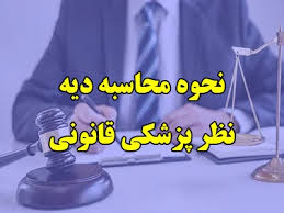 تعیین دیه با کیه؟