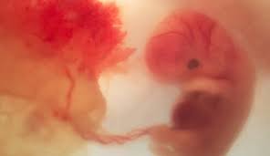 در مورد سقط جنین و مجازات آن چه میدانید؟